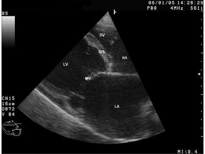 Ultrasound 